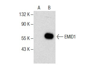 いちばんぼし EMID1抗体(G-12) | SCBT - Santa Cruz Biotechnology