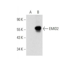 EMID2 Antibody (B-7) - Western Blotting - Image 320949