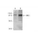 EML1 Antibody (B-3) - Western Blotting - Image 290815 