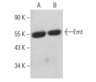 Emt Antibody (0.T.74) - Western Blotting - Image 363945 