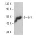 Emt Antibody (0.T.74) - Western Blotting - Image 363949 