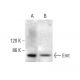 Emt Antibody (3F227) - Western Blotting - Image 383102