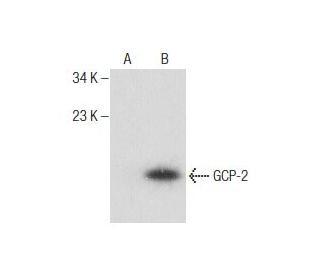 ENA-78 Antibody (D-6) - Western Blotting - Image 260772Each CRISPR/Cas9 Knockout (KO) Plasmid product consists of a pool of 3 plasmids designed to ensure identification and cleavage of a specific gene for maximum knockout efficiency. Each plasmid encodes a unique 20 nt sequence derived from the GeCKO (v2) library.