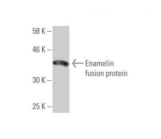 western blotting image from recommended Enamelin (2C12) monoclonal antibody replacement. Image 349014