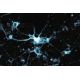 ENC1 Antibody (7a) - Immunofluorescence - Image 387944