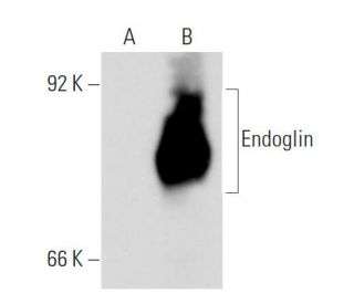 Endoglin/CD105 Antibody (2Q1707) - Western Blotting - Image 54113