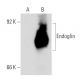Endoglin/CD105 Antibody (2Q1707) - Western Blotting - Image 54113