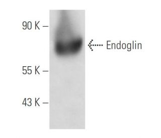 Endoglin/CD105 Antibody (43A3) - Western Blotting - Image 12045