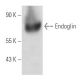 Endoglin/CD105 Antibody (43A3) - Western Blotting - Image 12045
