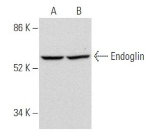 Endoglin/CD105 Antibody (8E11) - Western Blotting - Image 357678