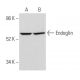 Endoglin/CD105 Antibody (8E11) - Western Blotting - Image 357678