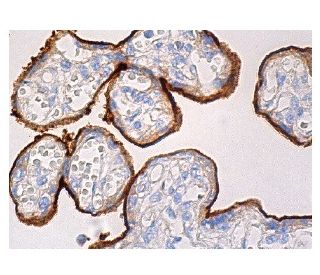Endoglin/CD105 Antibody (A-8) - Immunohistochemistry - Image 157923 