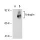 Endoglin/CD105 Antibody (MJ7/18) - Western Blotting - Image 54115