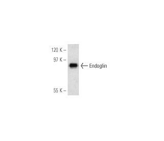 Endoglin/CD105 Antibody (P4A4) - Western Blotting - Image 6881 