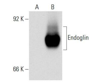Endoglin/CD105 Antibody (RM0030-6J9) - Western Blotting - Image 54117