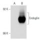 Endoglin/CD105 Antibody (RM0030-6J9) - Western Blotting - Image 54117