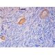 Endoglin/CD105 Antibody (SN6) - Immunohistochemistry - Image 293421 