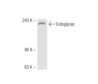 Endoglycan Antibody (Y122) - Western Blotting - Image 47472