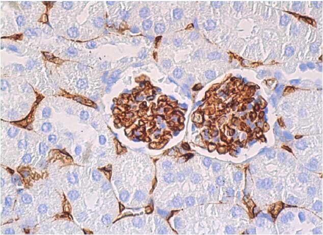 ばぁ! endomucin-antibody-v-7c7-