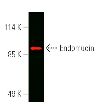 ばぁ! Endomucin Antibody (V.7C7) | SCBT - Santa Cruz Biotechnology