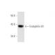 Endophilin B1 Antibody (30A882) - Western Blotting - Image 59249 