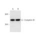 Endophilin B1 Antibody (A-9) - Western Blotting - Image 292992 