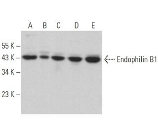 Endophilin B1 Antibody (G-6) - Western Blotting - Image 364506 
