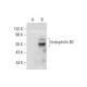 Endophilin B2 Antibody (A-10) - Western Blotting - Image 142708