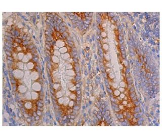 Endophilin B2 Antibody (A-12) - Immunohistochemistry - Image 350524 