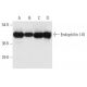 このポリクローナル抗体は販売終了となりました。弊社推奨の<a href="endophilin-i-antibody-d-3">Endophilin I (D-3)</a>モノクローナル抗体をご覧ください(サンプルデータを表示)。 western blotting image from recommended Endophilin I (D-3) monoclonal antibody replacement. Image 12709