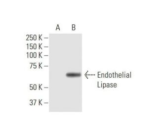 Endothelial Lipase Antibody (4A9) - Western Blotting - Image 352173 