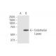 Endothelial Lipase Antibody (4A9) - Western Blotting - Image 352173 
