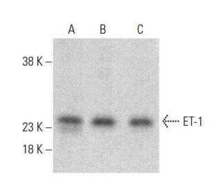 Endothelin-1/EDN1/ET-1 Antibody (C7) - Western Blotting - Image 399434SAM Transcription Activation: SAM system utilizing dCas9-VP64, MS2-P65-HSF1, and sgRNA for precise gene transcription activation.