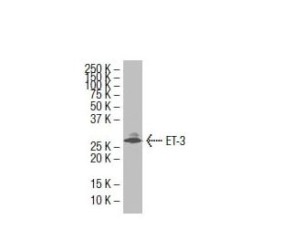 Endothelin-3/EDN3/ET-3 Antibody (5E8) - Western Blotting - Image 33595The Double Nickase Plasmid features a U6 promoter for sgRNA expression, a 20 nt targeting sequence, and a gRNA scaffold to guide Cas9n. It includes a CBh promoter for Cas9n (D10A) and puromycin resistance, GFP for transfection verification, and nuclear localization signals (NLS). The 2A peptide allows co-expression of Cas9n and Puro from a single promoter, enabling precise genome editing with reduced off-target effects.