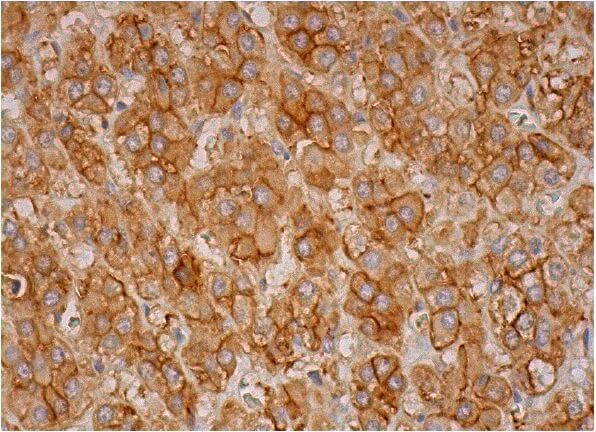 切手27 ENT1 Antibody (F-12) | SCBT - Santa Cruz Biotechnology