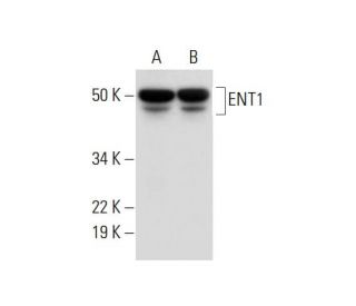 切手27 ent1-antibody-f-12-western-