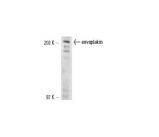 envoplakin Antibody (CRENV-1) - Western Blotting - Image 13620