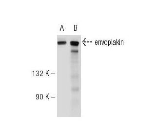 envoplakin Antibody (F-4) - Western Blotting - Image 55299 