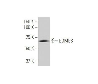 EOMES Antibody (1A8) - Western Blotting - Image 352164Each CRISPR/Cas9 Knockout (KO) Plasmid product consists of a pool of 3 plasmids designed to ensure identification and cleavage of a specific gene for maximum knockout efficiency. Each plasmid encodes a unique 20 nt sequence derived from the GeCKO (v2) library.