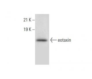 eotaxin Antibody (C-19): sc-6181
