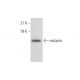 이 다클론 항체는 생산이 중단되었습니다. 권장 <a href="eotaxin-antibody-c-3">eotaxin (C-3)</a> 단클론 항체(샘플 데이터 표시)를 참조하세요. western blotting image from recommended eotaxin (C-3) monoclonal antibody replacement. Image 303831