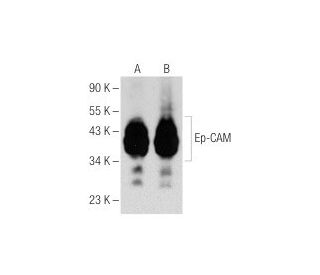 Ep-CAM Antibody (0.N.276) - Western Blotting - Image 160237 