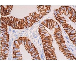 Ep-CAM Antibody (5F209) - Immunohistochemistry - Image 355411 
