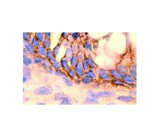 Ep-CAM Antibody (9C4) - Immunohistochemistry - Image 7967 