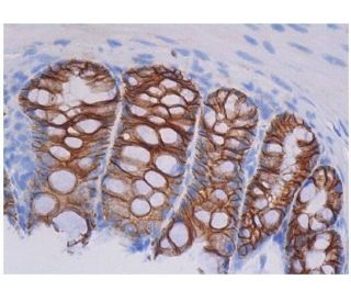 Ep-CAM Antibody (G8.8) - Immunohistochemistry - Image 353830 