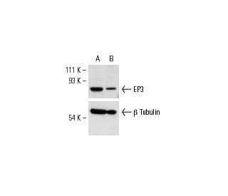 EP3 siRNA (h): sc-35314. Western blot analysis of EP3 expression in non-transfected control (A) and EP3 siRNA transfected 