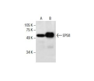EP58 Antibody (C-3) - Western Blotting - Image 285881 