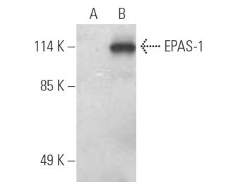 EPAS-1/HIF-2 alpha Antibody (190b) - Western Blotting - Image 394947