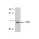 EPDR1 Antibody (F-6) - Western Blotting - Image 378147