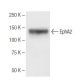 EphA2 Antibody (3D7) - Western Blotting - Image 62768 